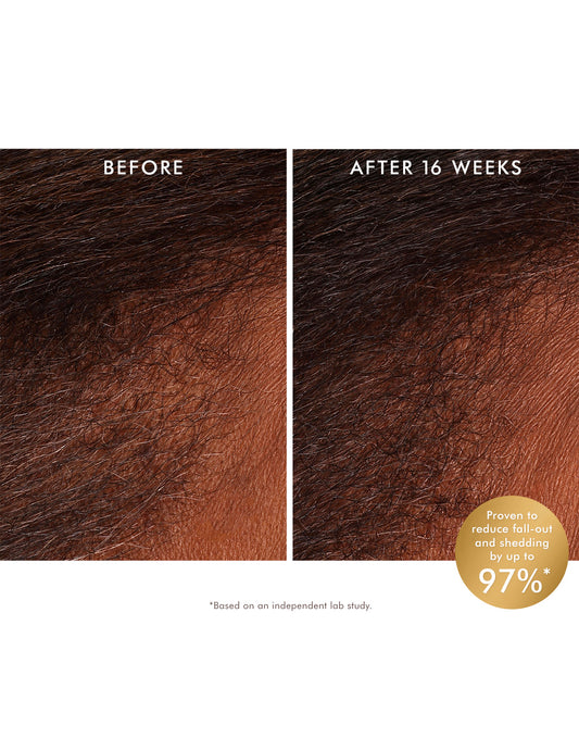 tonico per crescita capelli/ Tonico e siero rivitalizzante per cuoio capelluto